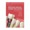 Del Río - Prótesis dental  sobre implantes - Lisermed