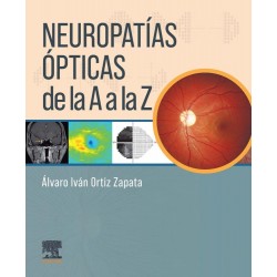 Ortiz - Neuropatías ópticas...