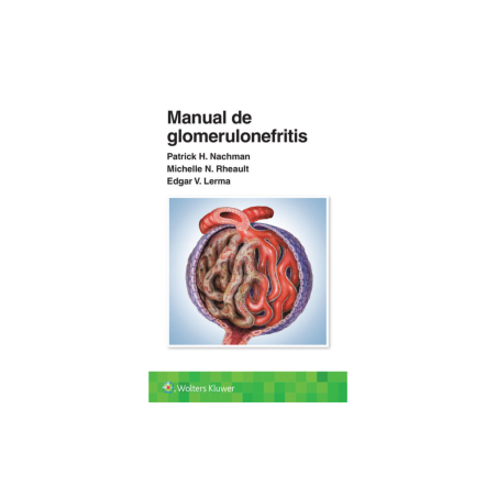 Nachman - Manual de glomerulonefritis - Wolters Kluwer 2024