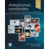 González - Aneurismas cerebrales - Elsevier