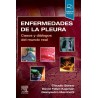 Sorino - Enfermedades de la pleura - Elsevier 2022