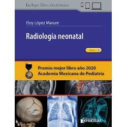 LÓPEZ - RADIOLOGÍA NEONATAL...