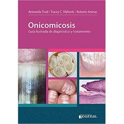 Tosti - Onicomicosis - Journal