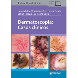 CABO - DERMATOSCOPIA: CASOS...