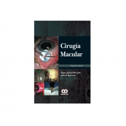 Quiroz - Cirugía macular -...